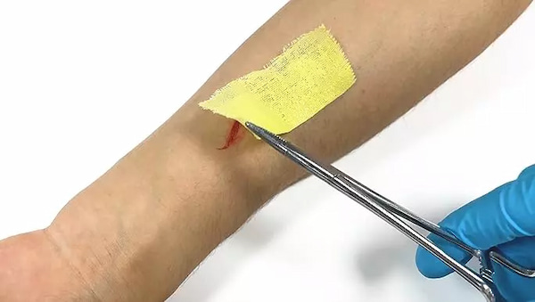 تصویر 5 از قیمت گاز وازلین برای سوختگی + خرید باور نکردنی